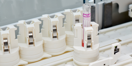 Intelligent Tube Routing in Lab Automation Can Improve Turnaround Times