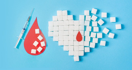 Diabetes Testing: How Can Labs Prepare for Post-pandemic
