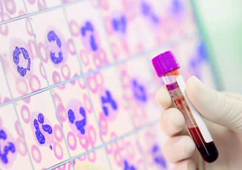 5 part diff hematology analyzer media showcase
