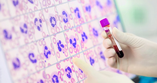Go to the Next Level with 5-Part Differential Hematology Analyzers