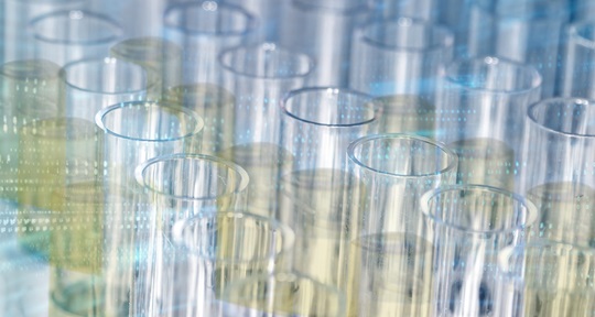 Is There a Need for Urinalysis Validation Software?
