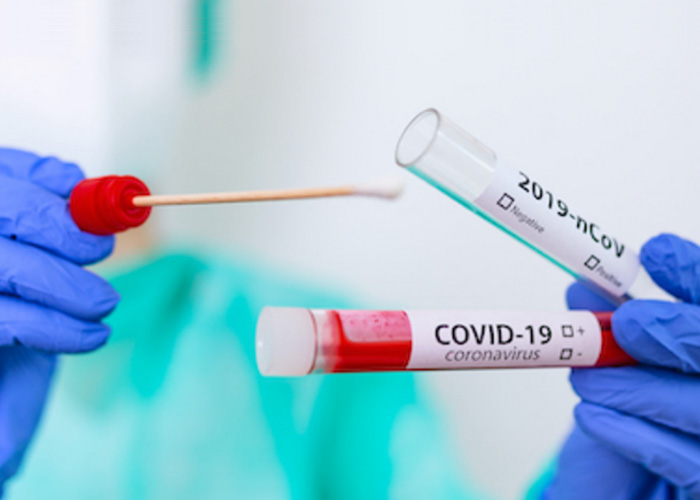 Real world COVID-19 Testing Insights