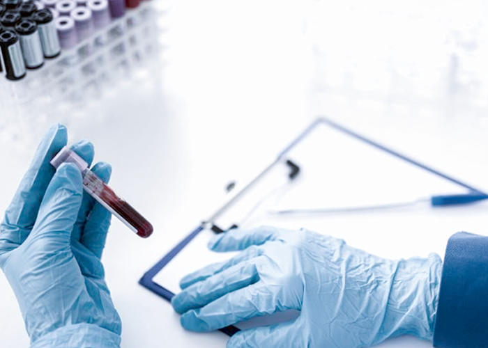 Sepsis Alliance webinar