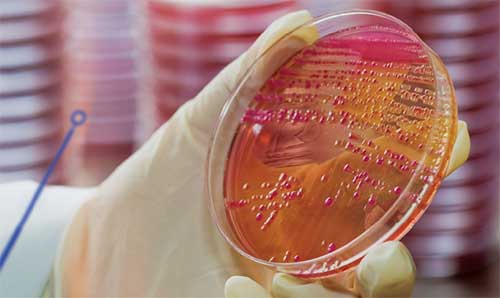 Antibiotic Stewardship Software LabPro-MBT | Beckman Coulter