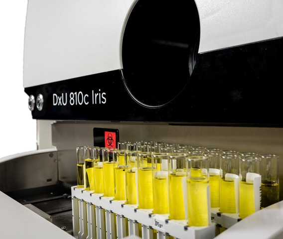 Urine Chemistry Analyzer DxU 810c Iris | Beckman Coulter