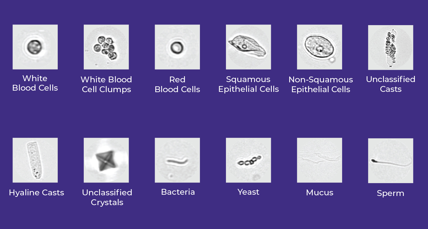 DxU-Iris-Standard-Particle-Classification